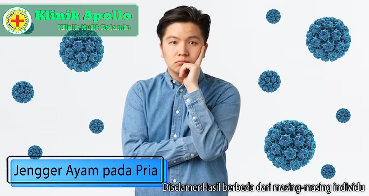 Anda bisa mengobati kondisi jengger ayam pada pria di Klinik Apollo Jakarta dengan dokter ahli.