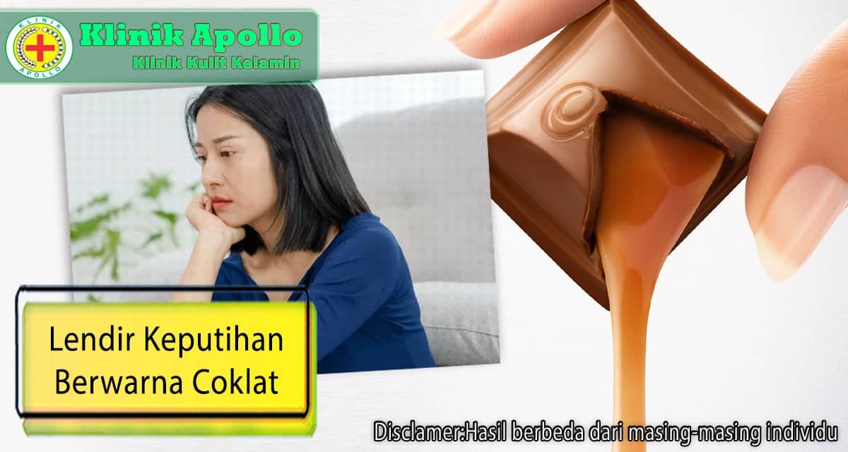 Klinik Apollo memiliki dokter ahli ginekologi yang ahli dapat menangani wanita dengan lendir keputihan berwarna coklat.