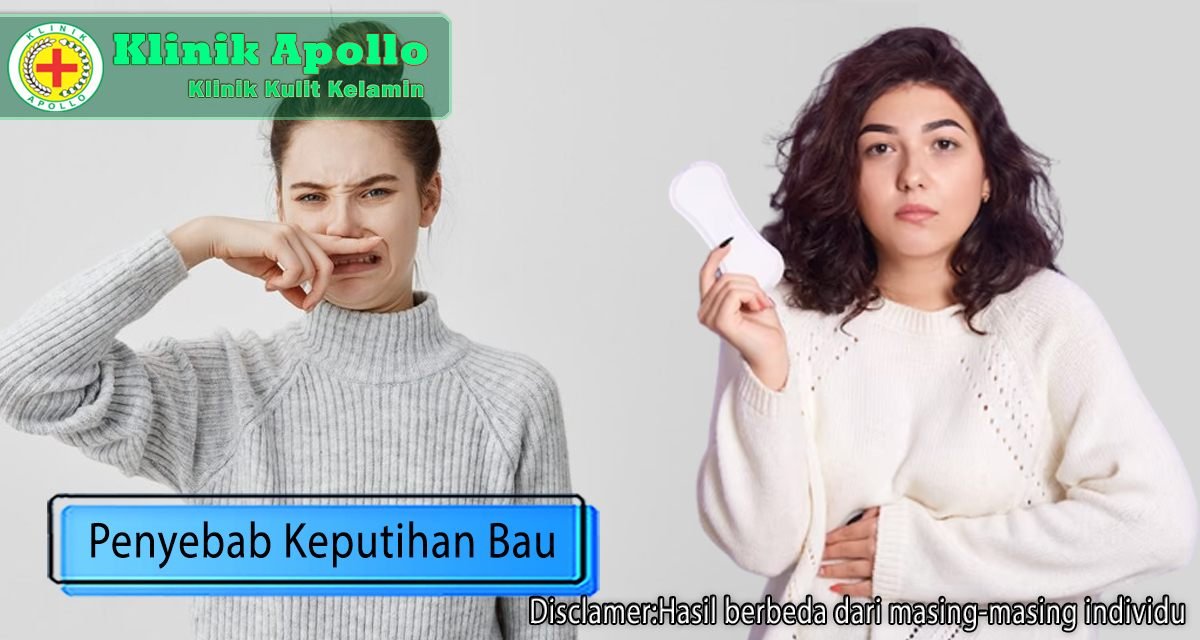 Penyebab Keputihan Bau Kenapa Terjadi Dan Cara Mengatasinya Klinik