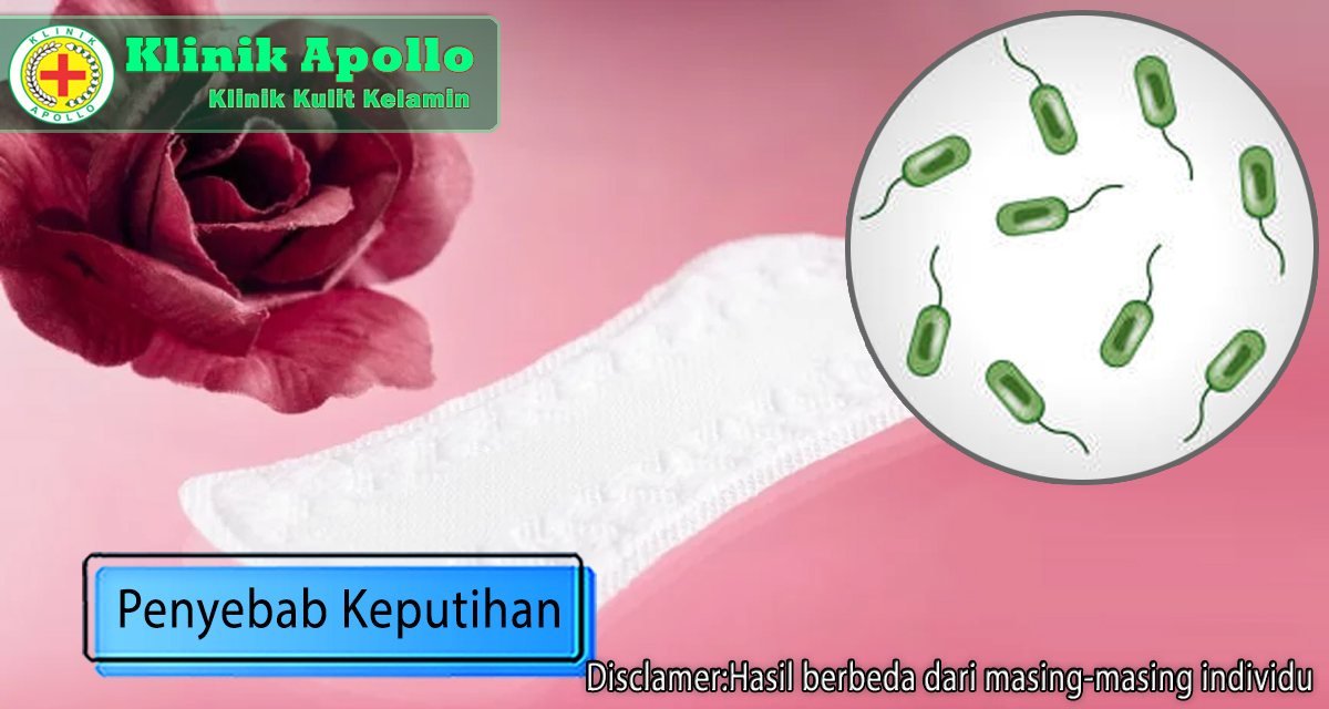 Faktor Dan Penyebab Keputihan Pada Wanita Perlu Anda Ketahui Klinik