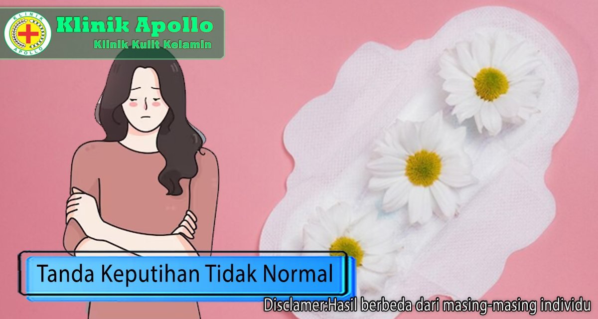 Setelah mengetahui tanda keputihan tidak normal, maka dapat melakukan pengobatan dengan tepat.