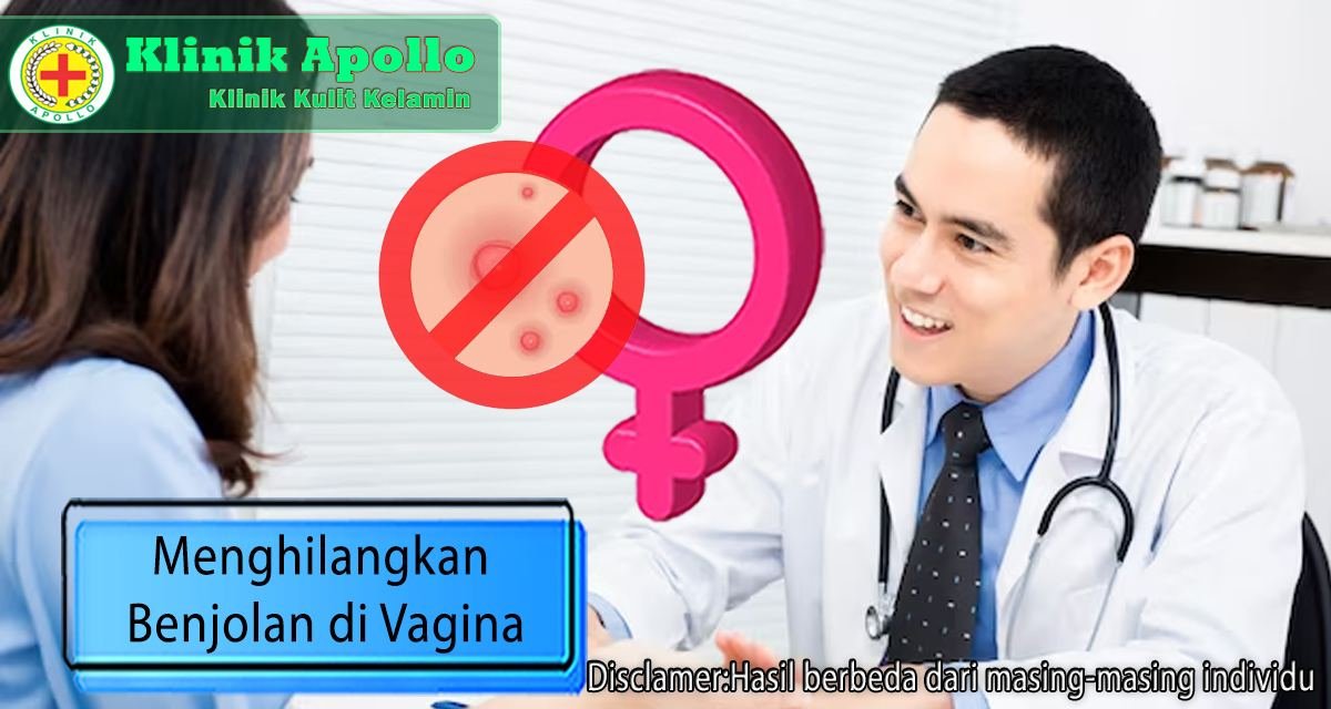 Cara Menghilangkan Benjolan di Vagina, Jangan Disentuh