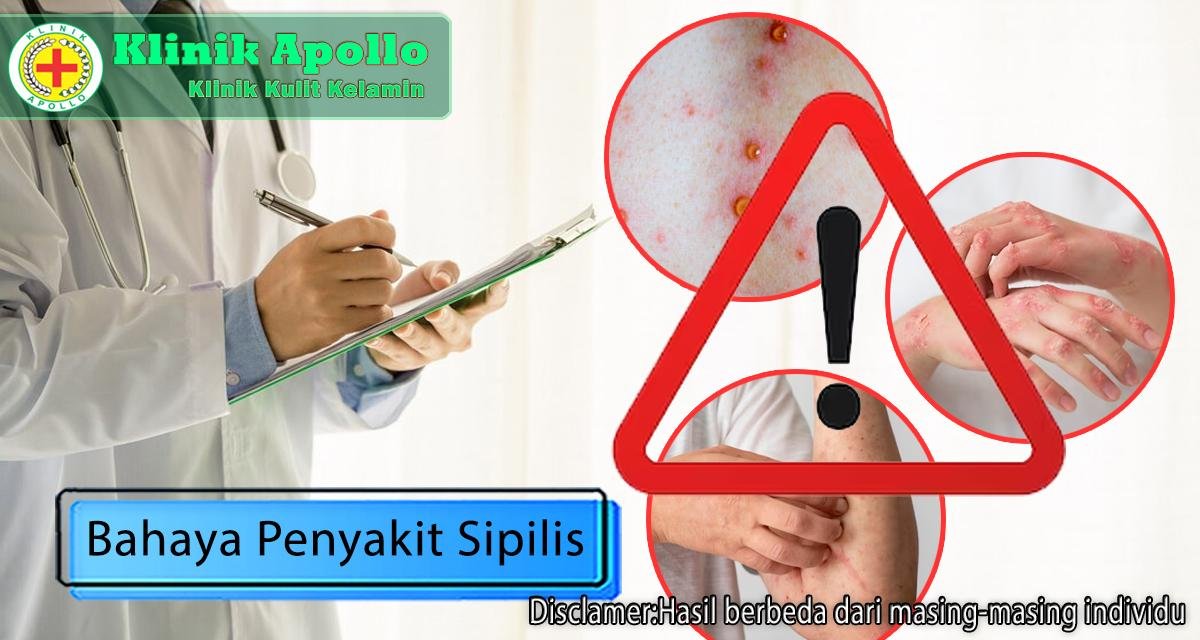 Anda tidak akan mengalami bahaya penyakit sipilis jika melakukan penanganan dengan dokter ahli di Klinik Apollo Jakarta.