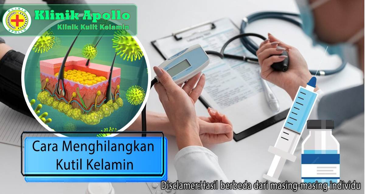 Untuk mengetahui cara menghilangkan kutil kelamin, lakukan konsultasi dengan dokter ahli.