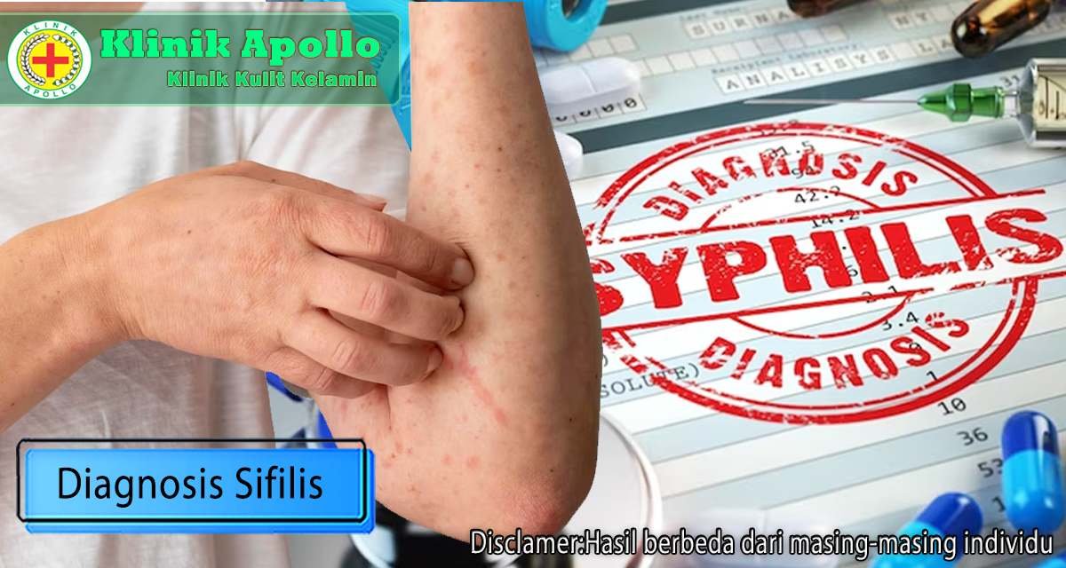 Diagnosis sifilis dapat Anda dapatkan setelah Anda melakukan pemeriksaan dengan dokter ahli.