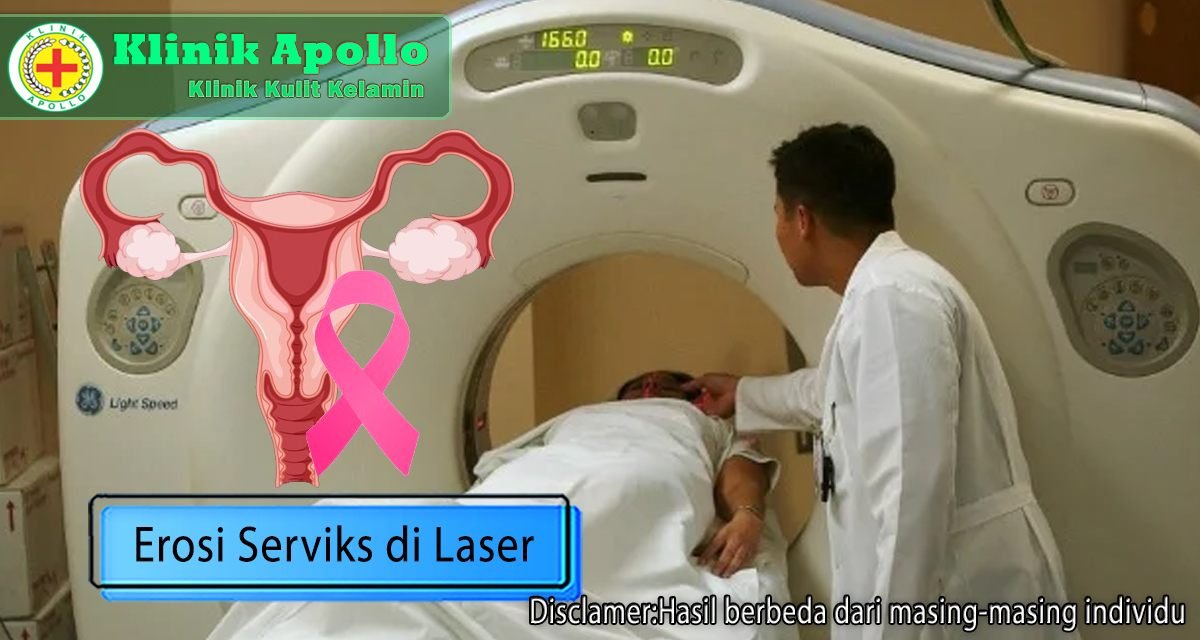Erosi serviks di laser adalah salah satu perawatan terbaik di Klinik Apollo.