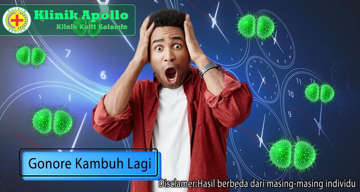 Jika gonore kambuh lagi, perhatian pencegahan yang harus Anda lakukan sesuai rencana dari dokter ahli.