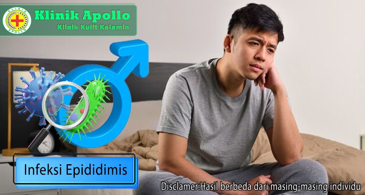 Infeksi epididimis jika tidak segera diobati dapat menyebabkan komplikasi seperti nyeri atau pembengkakan.
