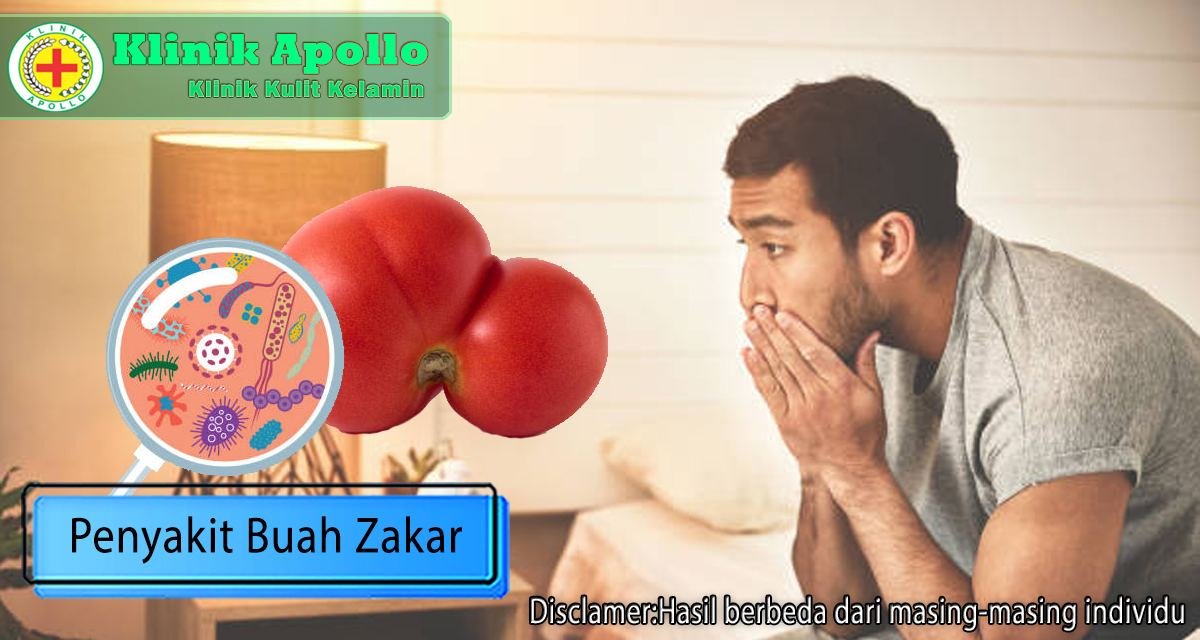 Penyakit buah zakar dapat disembuhkan oleh dokter ahli andrologi di Klinik Apollo Jakarta.