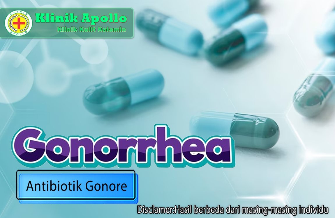 Cara Mendapatkan Antibiotik yang Cocok untuk Gonore