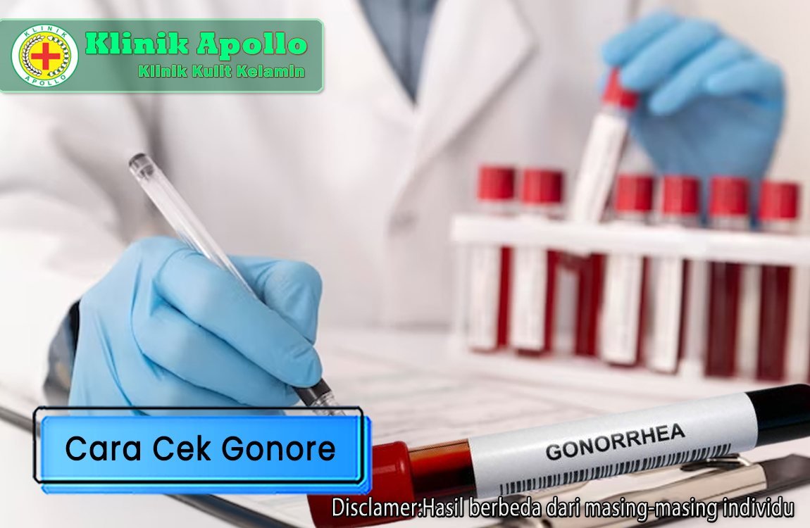 Dokter ahli akan merekomendasikan Anda cara cek gonore yang tepat jika telah melakukan konsultasi dan pemeriksaan.