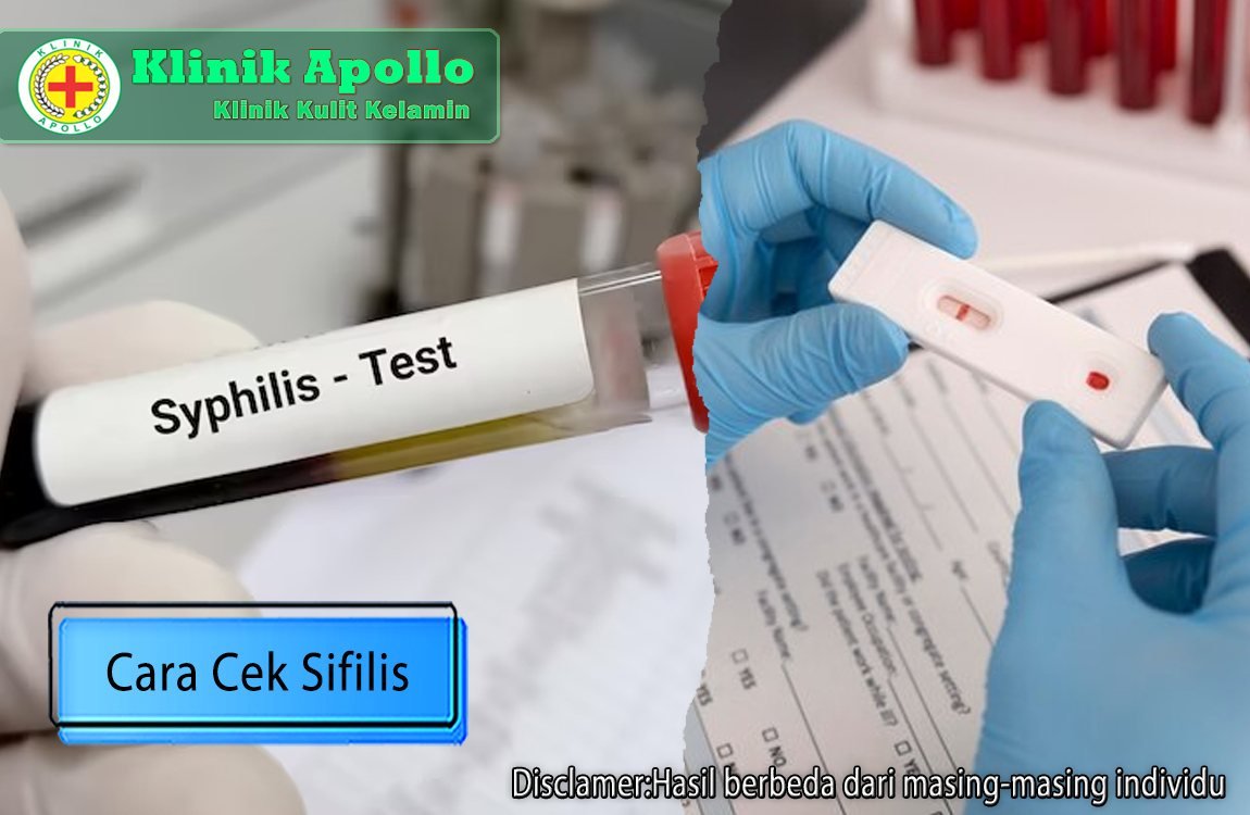 Cara cek sifilis yang paling tepat dan cepat hanya ada di Klinik Apollo Jakarta.