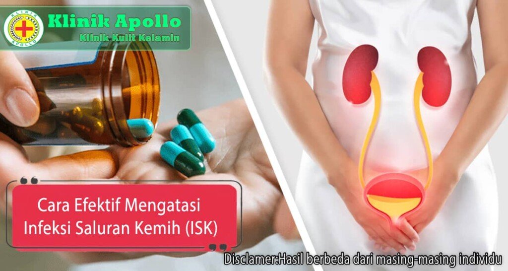 Langkah Efektif Dan Cara Mengatasi Isk Untuk Kesehatan Kemih Klinik