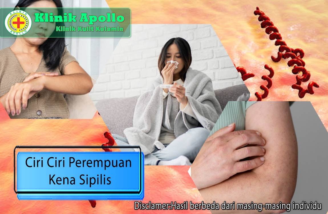 Banyak dijumpai ciri ciri perempuan kena sipilis di kota-kota besar, segera lakukan pemeriksaan medis dengan dokter ahli di Klinik Apollo.