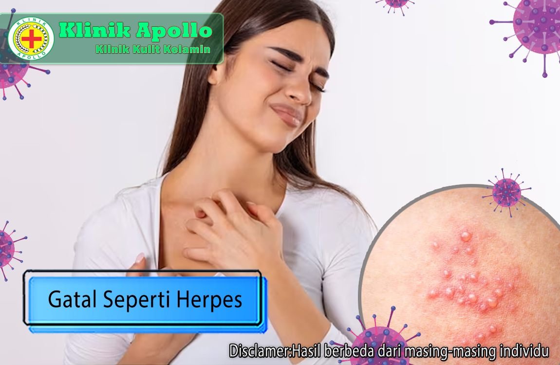 Kondisi gatal seperti herpes jangan pernah dibiarkan, lakukan penanganan medis di klinik dengan dokter ahli.
