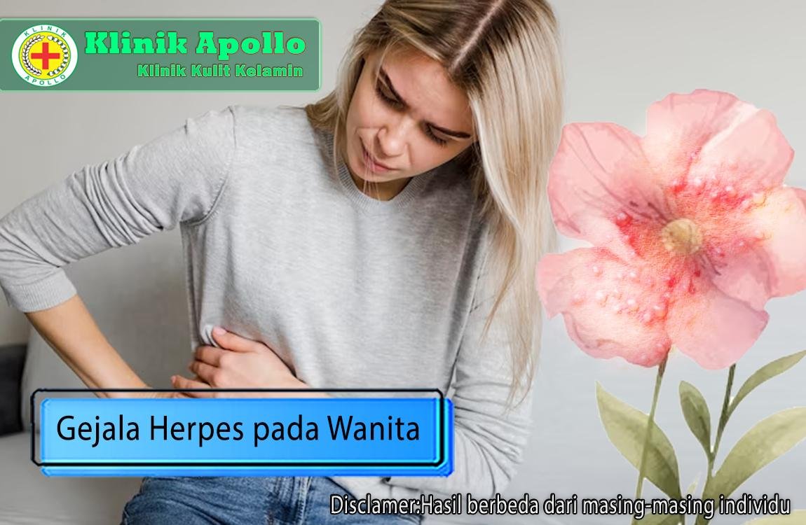 Pentingnya mengenali gejala herpes pada wanita dengan pemeriksaan medis di klinik.