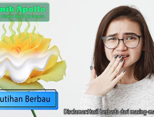 Begini Cara Menghilangkan Keputihan Perempuan Klinik Apollo Jakarta 2570