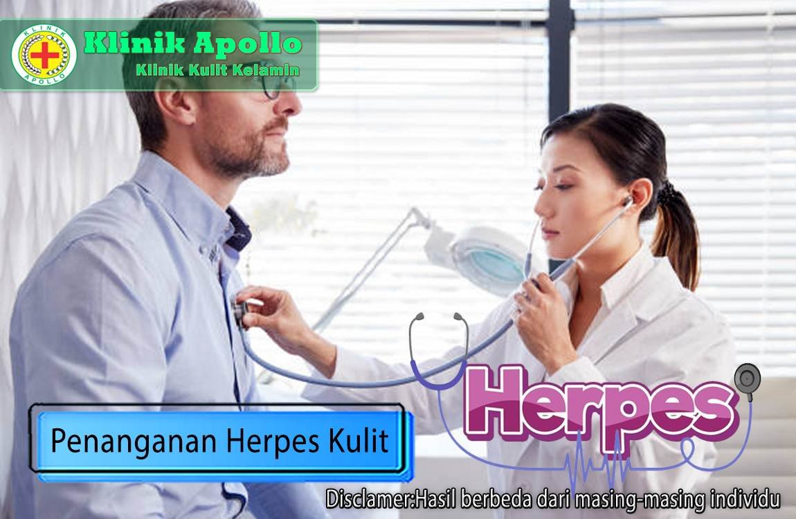 Hubungi dokter ahli untuk melakukan penanganan herpes kulit dengan cepat dan tepat.