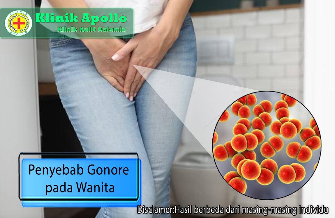 Membedah Penyebab Gonore pada Wanita dan Obat yang Efektif