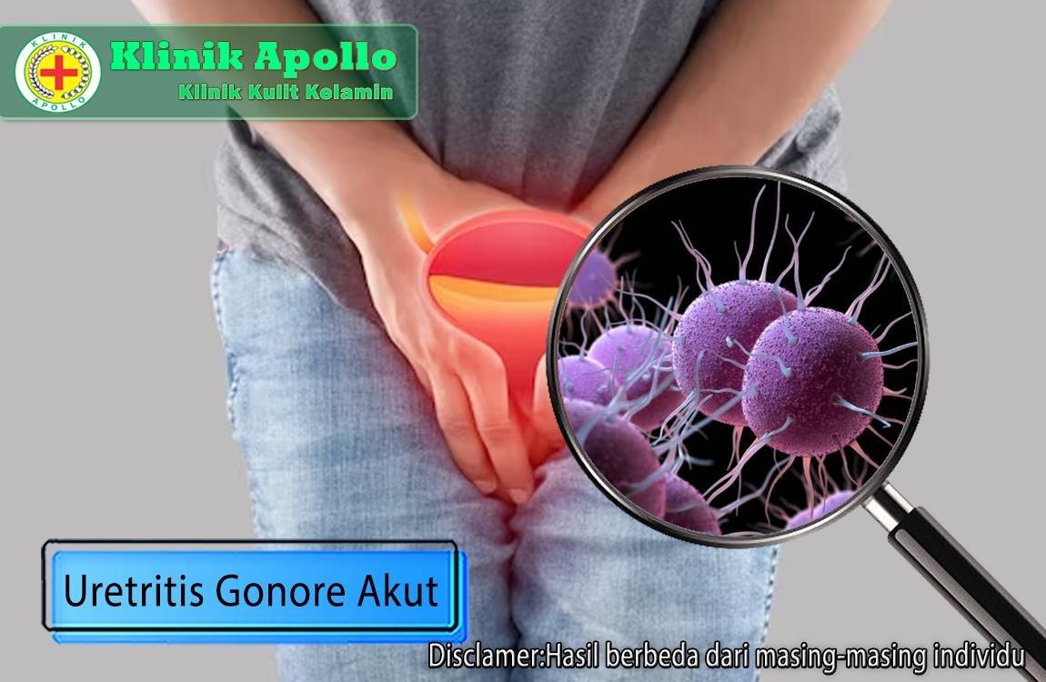 Anda tidak perlu khawatir, penyakit uretritis gonore akut dapat ditangani di Klinik Apollo Jakarta.