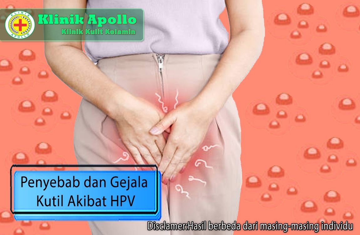 Ketahui dengan pemeriksaan medis mengenai penyebab dan gejala kutil akibat HPV di Klinik Apollo.