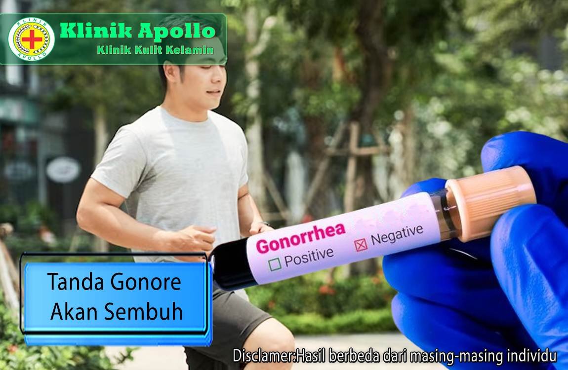 Untuk mengetahui tanda gonore akan sembuh dengan rutin pemeriksaan dokter ahli di Klinik Apollo.