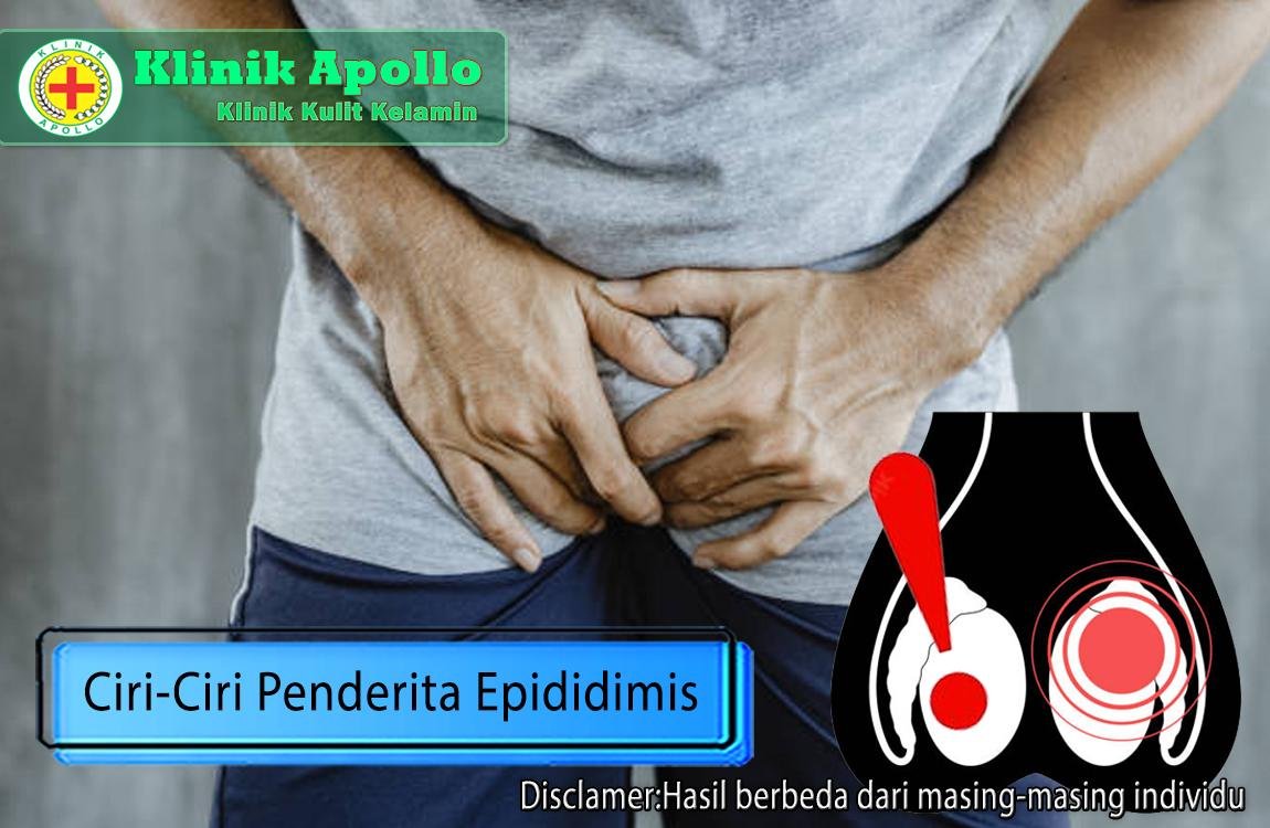 Terjebak dalam Ketidaknyamanan, 7 Ciri-Ciri Penderita Epididimis | Klinik Apollo Jakarta