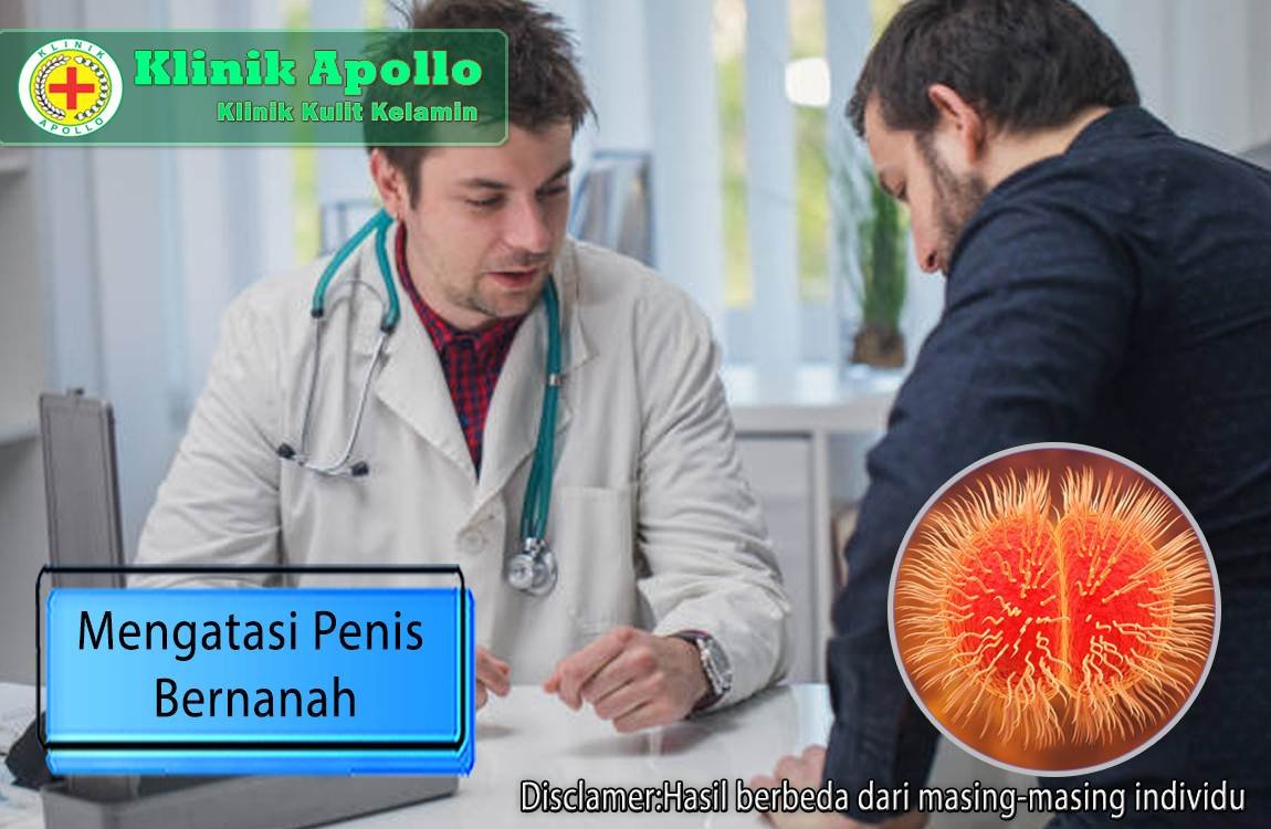 Ketahui dengan pasti bagaimana mengatasi penis bernanah di Klinik Apollo.