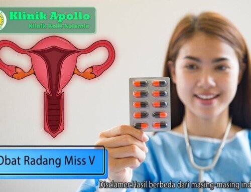 Obat Radang Miss V, Solusi untuk Kesehatan Intim Wanita