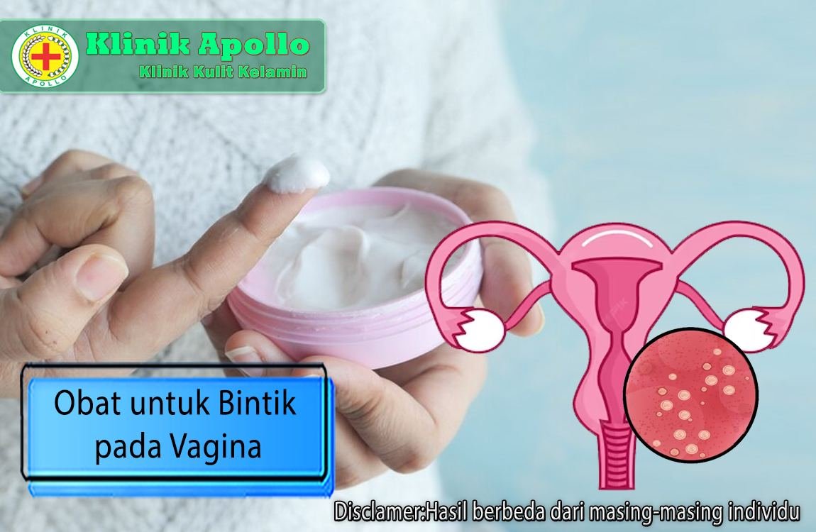 Rekomendasi obat untuk bintik pada vagina wanita hanya di Klinik Apollo.