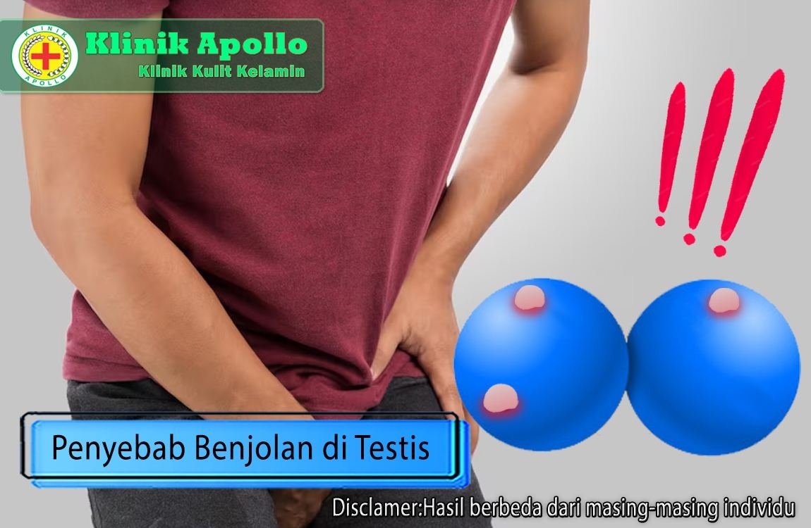 Ketahui penyebab benjolan di testis pria dengan pemeriksaan medis di Klinik Apollo.