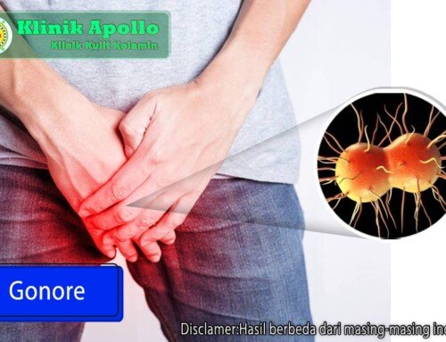 Apa Itu Fimosis? Pentingnya Memahami Fimosis pada Pria | Klinik Apollo ...