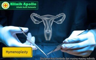 Percayakan operasi hymenoplasty hanya pada Klinik Apollo Jakarta.