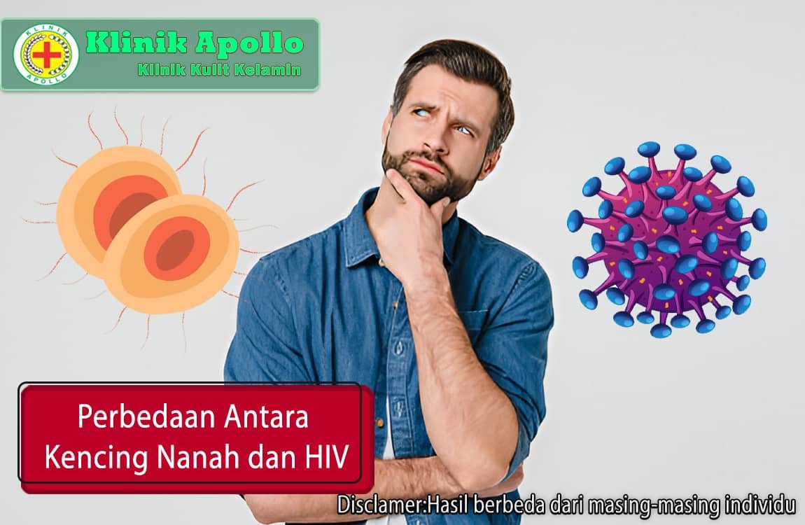 Untuk mengetahui perbedaan antara kencing nanah dan HIV adalah dengan melakukan pemeriksaan medis dengan dokter ahli di Klinik Apollo.