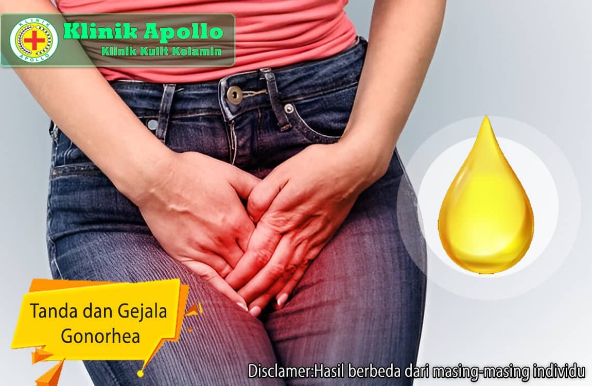 Untuk Anda mengetahui tanda dan gejala gonorhea adalah dengan melakukan pemeriksaan medis di Klinik Apollo Jakarta.