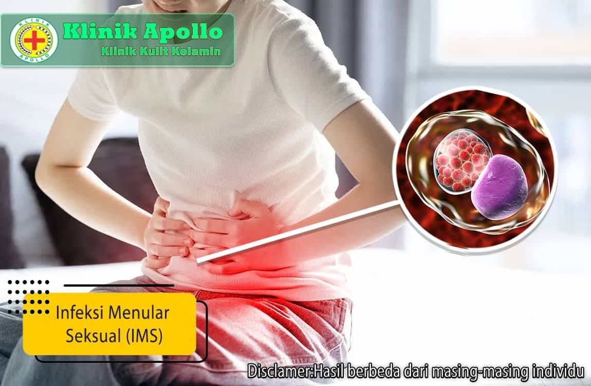 Tidak perlu bingung ketika mengalami infeksi menular seksual (IMS), segera lakukan pemeriksaan dengan dokter ahli di Klinik Apollo.