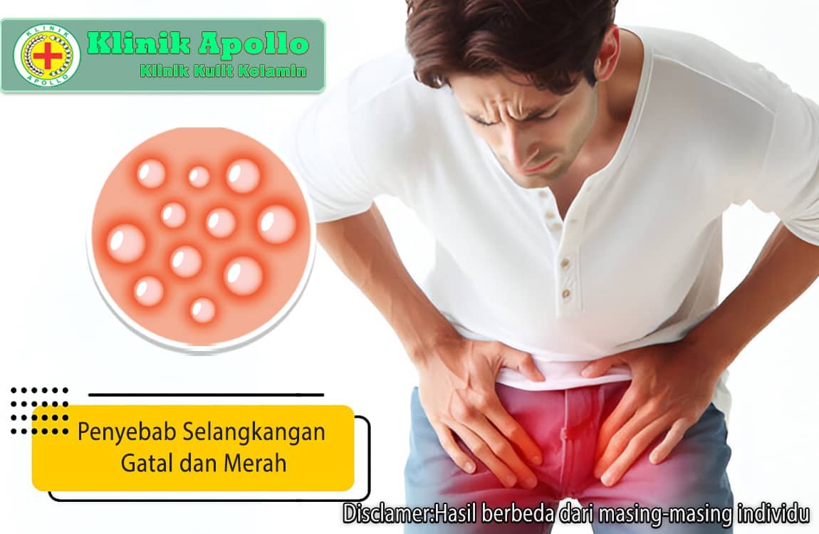 Untuk mengetahui penyebab selangkangan gatal dan merah adalah dengan melakukan pemeriksaan dokter ahli.