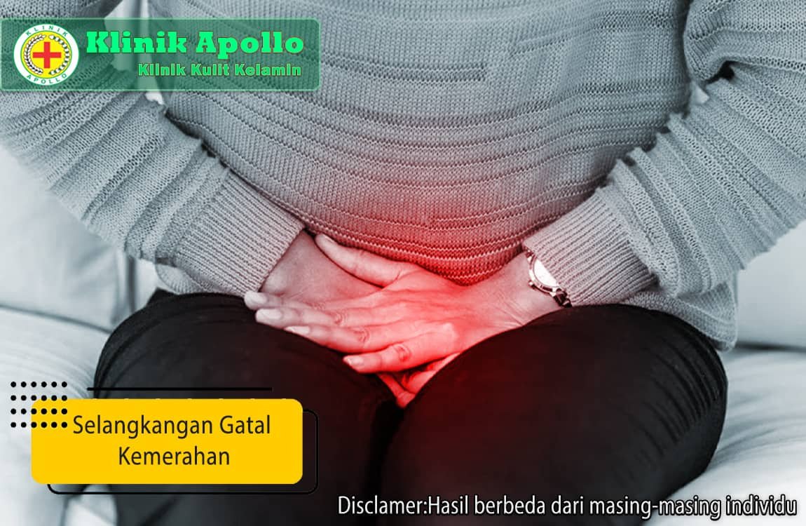 Tidak perlu khawatir, penanganan untuk selangkangan gatal kemerahan bisa Anda lakukan di Klinik Apollo.