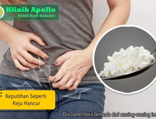 Keputihan Seperti Keju Hancur? Intip Begini Cara Mengatasinya