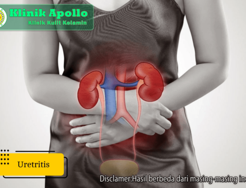 Kenali 5 Perbedaan Uretritis dan ISK, Berikut Cara Menanganinya