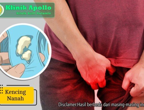 Perhatikan! 5 Resiko Kencing Nanah yang Tidak Segera Diobati