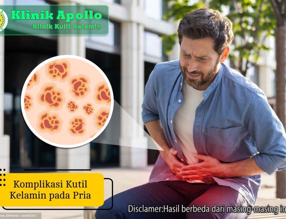 Kerap Tidak Disadari Begini Cara Mengobati Sifilis Primer Klinik 