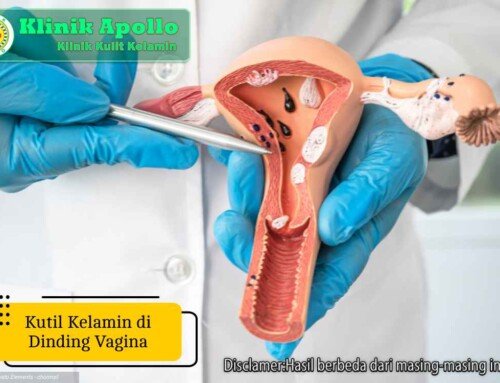 Ketahui! 5 Penyebab Munculnya Kutil Kelamin di Dinding Vagina