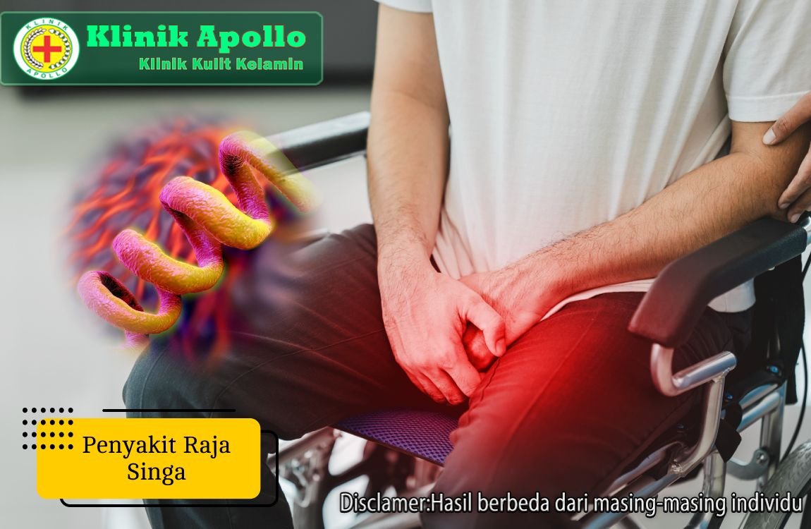 Jangan abaikan penyakit raja singa, segera lakukan pemeriksaan dengan dokter ahli di Klinik Apollo Jakarta.