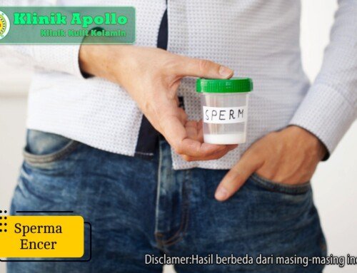 Jangan Sepelekan Pria Alami Sperma Encer, Begini Menanganinya