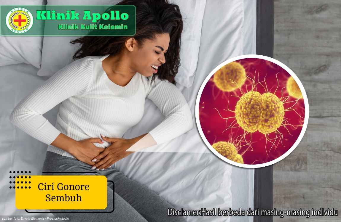 Untuk mengetahui ciri gonore sembuh adalah dengan melakukan pemeriksaan medis dengan dokter ahli di Klinik Apollo.