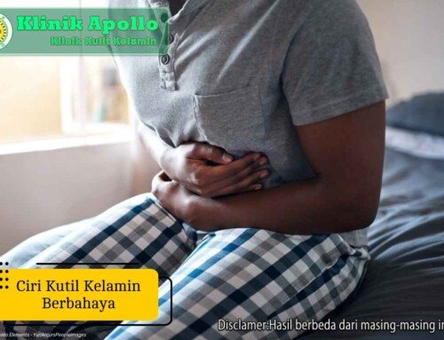 Ketahui, 5 Ciri Kutil Kelamin Berbahaya Berikut Penanganannya