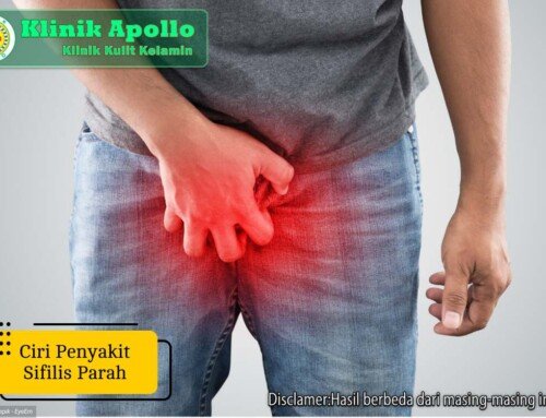 Jangan Abai! Inilah 5 Ciri Penyakit Sifilis Parah Tanpa Pengobatan