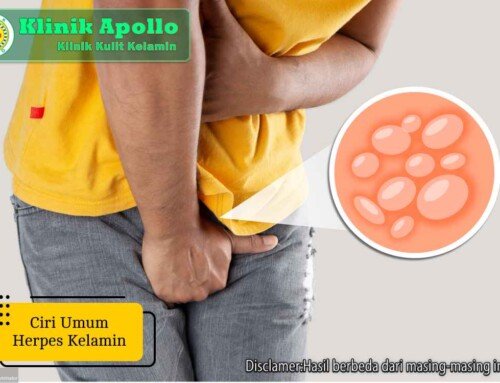 Waspada! 5 Ciri Umum Herpes Kelamin Berbahaya pada Remaja