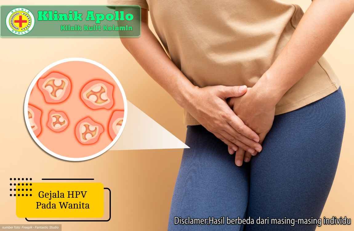 Ilustrasi Gejala HPV Pada Wanita.